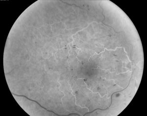 mid atlantic retina