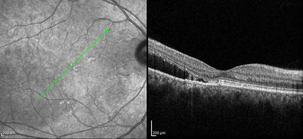 mid atlantic retina insurance