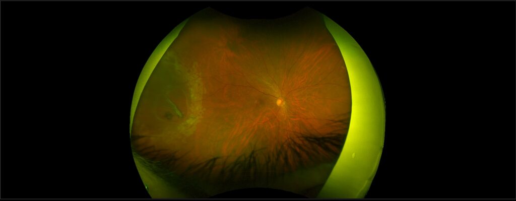 dr david fisher mid atlantic retina