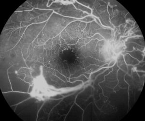 mid atlantic retina locations