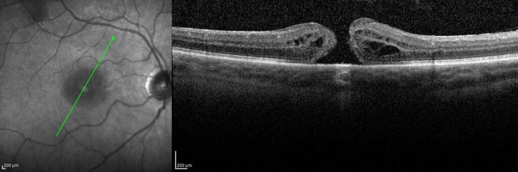 mid atlantic retina locations