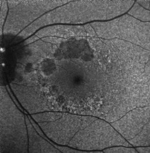 mcnamara mid atlantic retina