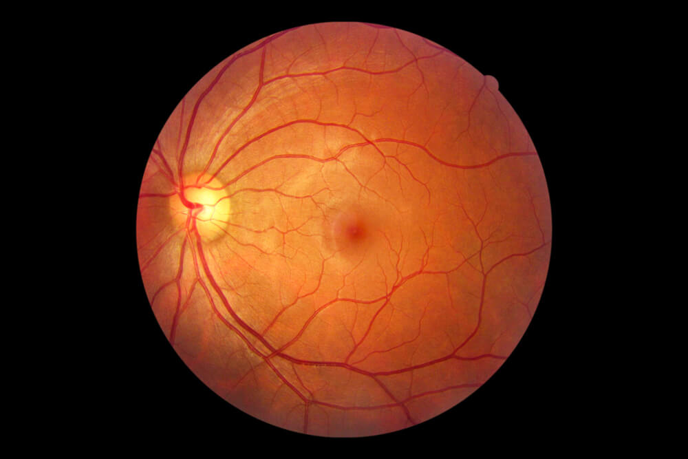 What is Retinal Imaging